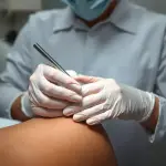 Easy Look Arenys – Micropigmentación Capilar