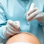 Esther Estètic – Micropigmentación Capilar