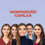 micropigmentacion-capilar-jerez-de-la-frontera