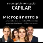 micropigmentacion-capilar-puig-reig